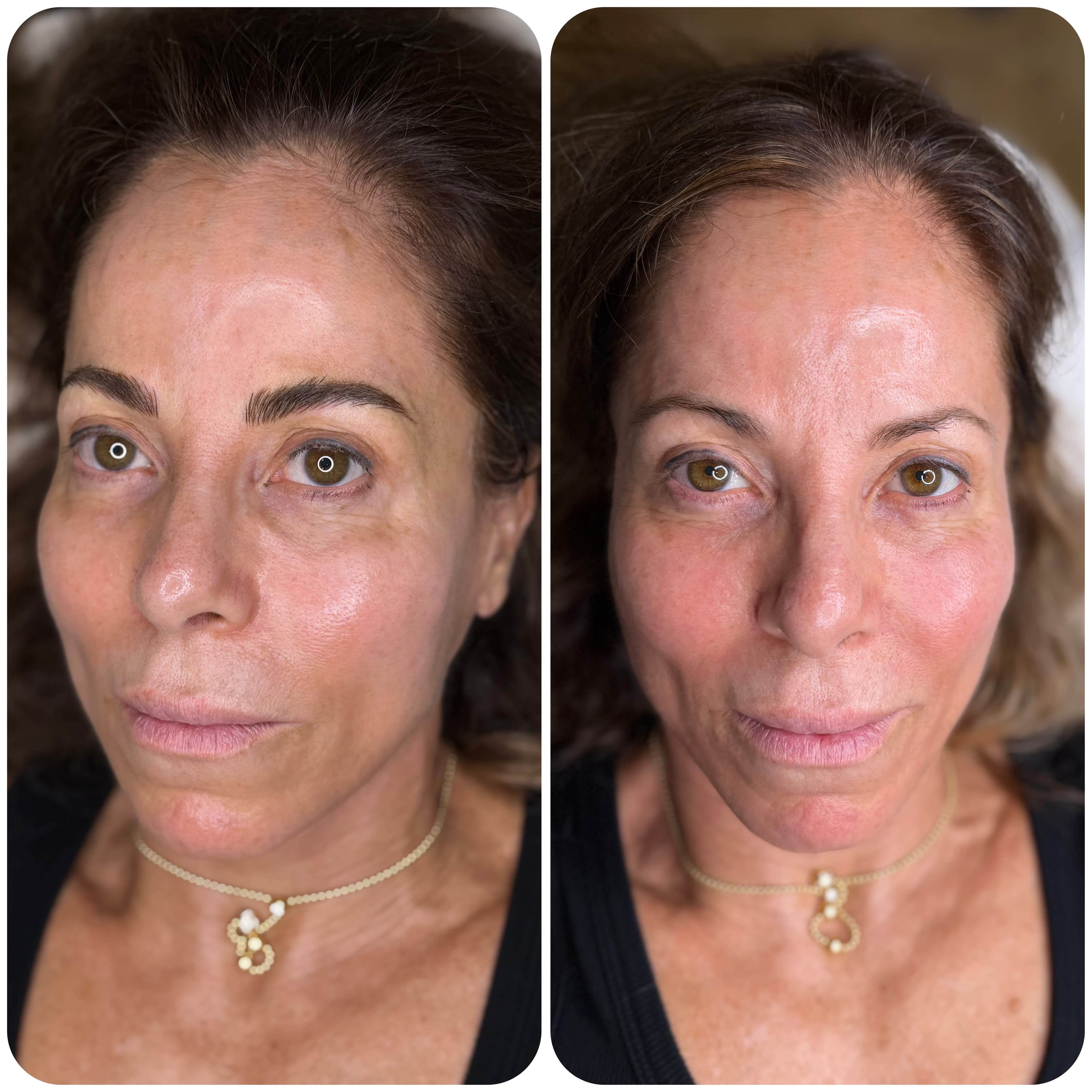 Microblading before and after result, photo 2 of 5