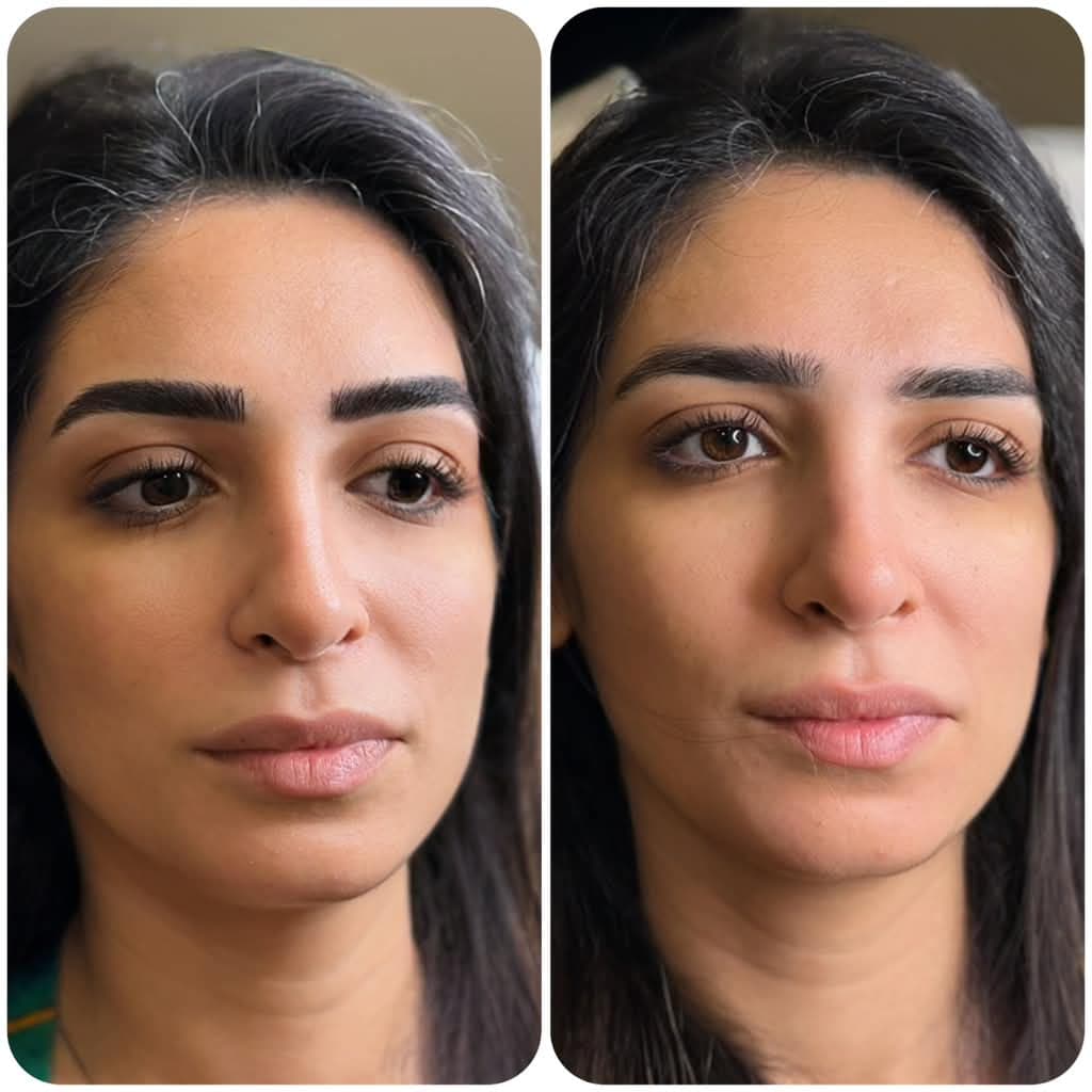 Microblading before and after result, photo 3 of 5